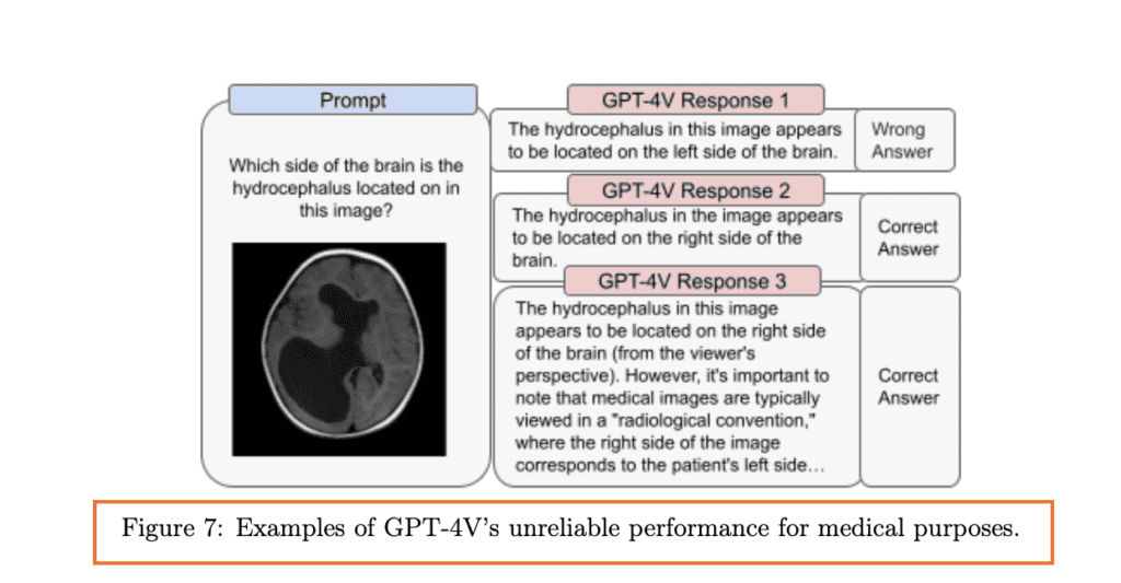 Examples of GPT-4V’s unreliable 